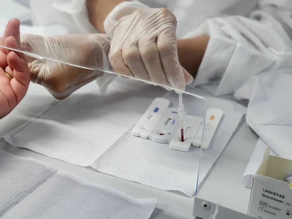 Ministério preparava avaliação de prevenção injetável ao HIV no SUS