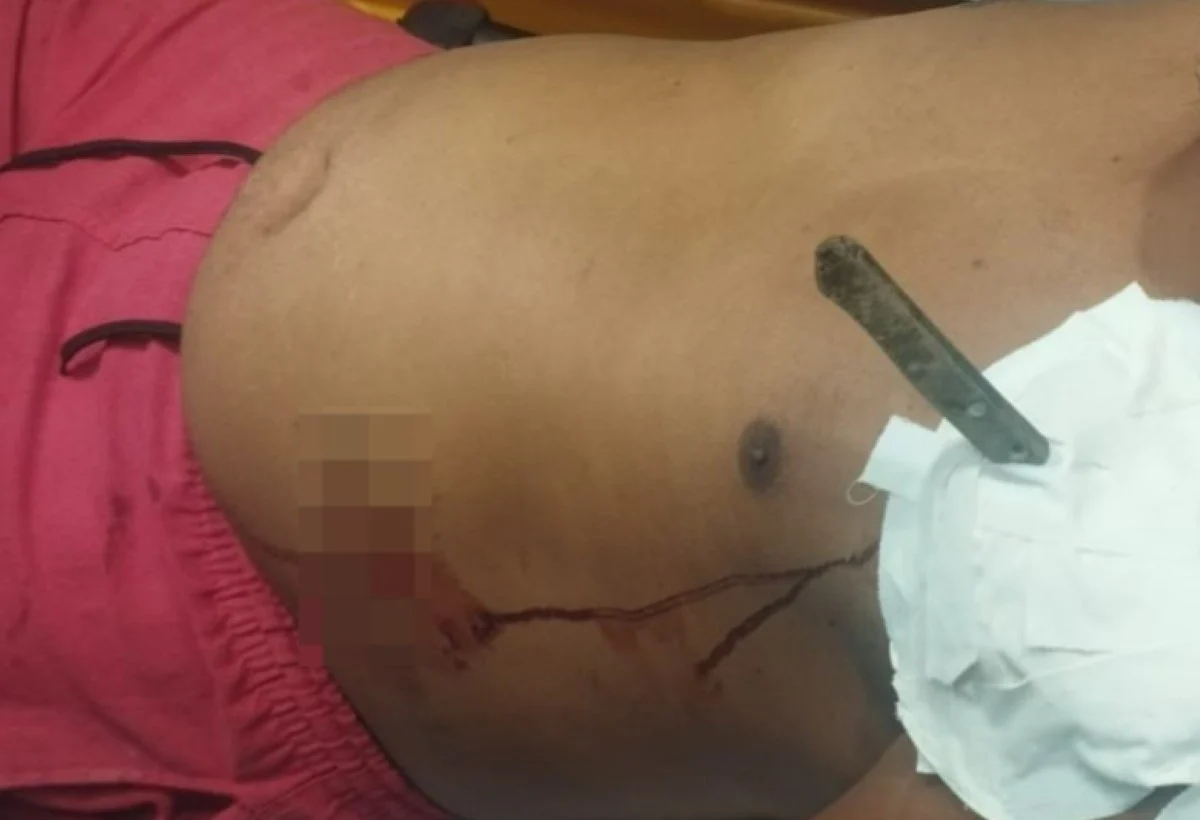 Homem ferido por faca recebe socorro no centro de Gongogi